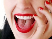 Wisdom Teeth Removal Bella Vista,  NSW | Emergency Dental Care